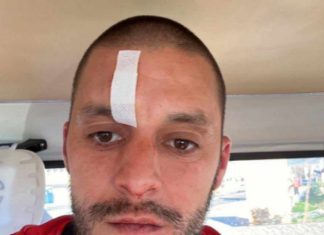 Футболист на Атлетик (Куклен) с 4 шева в болница след жесток побой на мач в Несебър